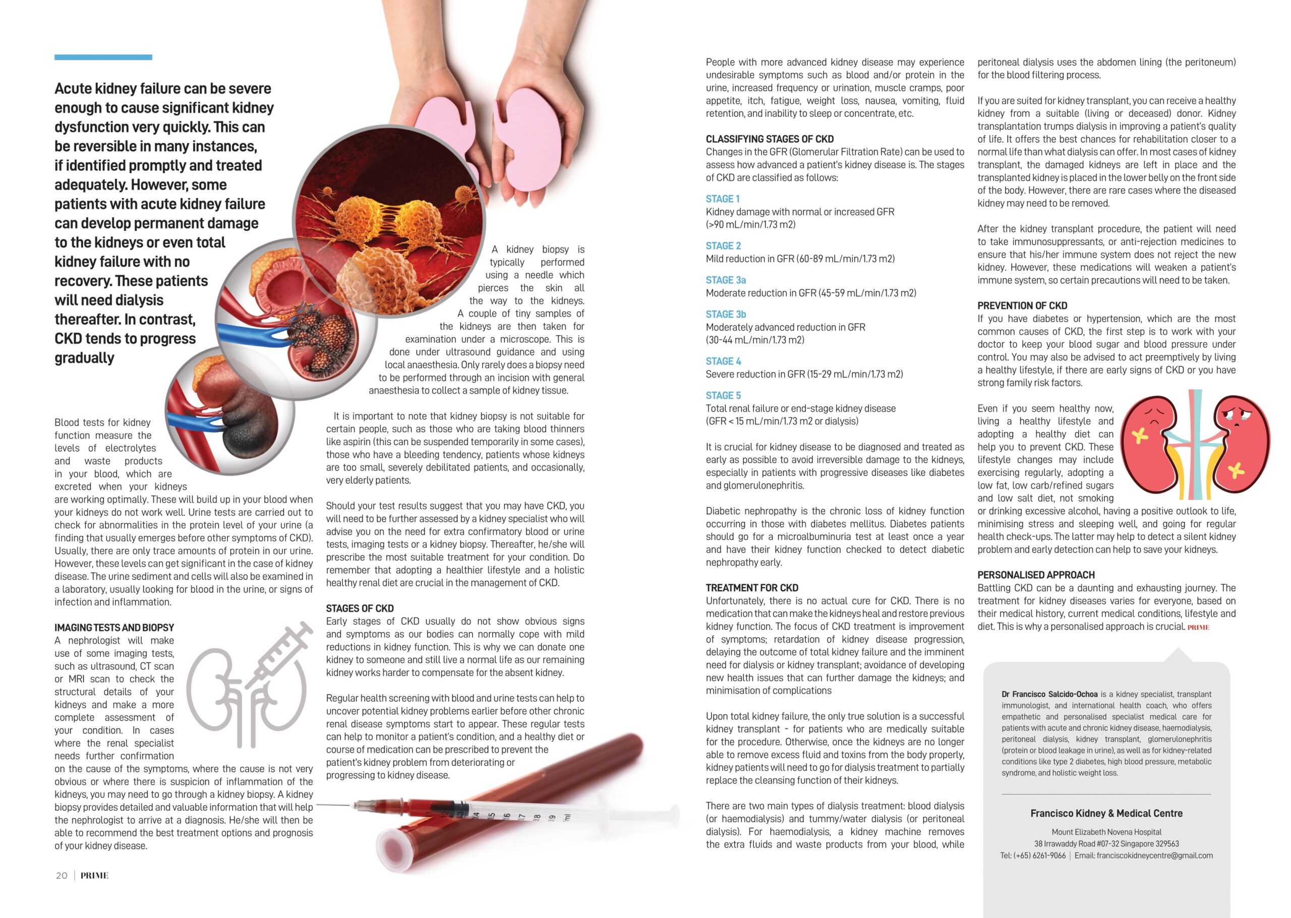 Chronic Kidney Disease (CKD) Article by Dr Francisco - Featured on Prime Magazine Singapore-pg2